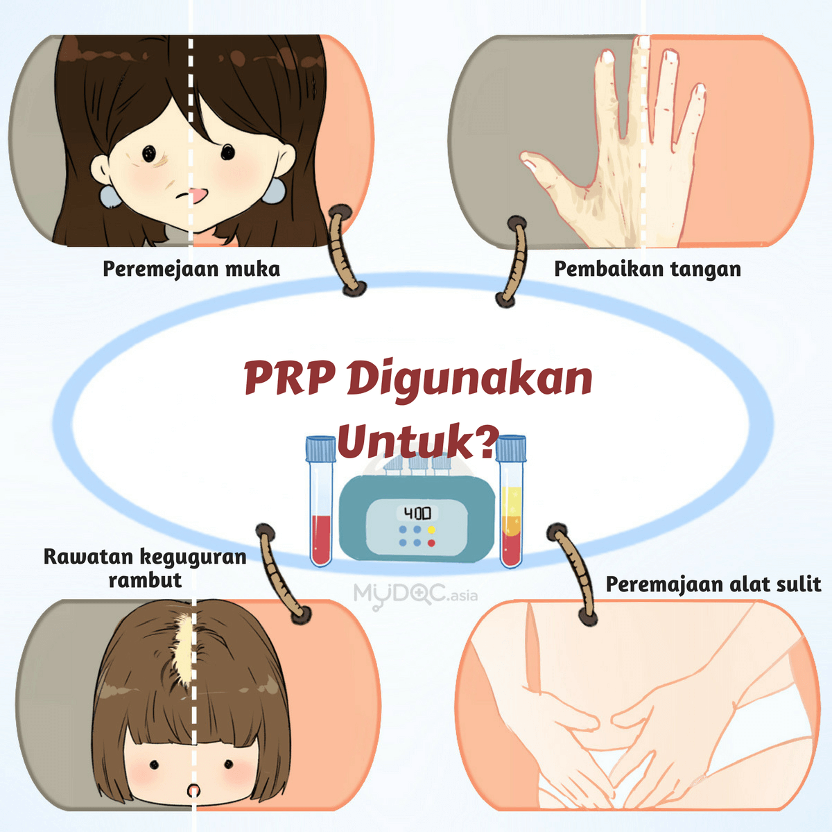 Suntikan PRP untuk Wajah: Penyelesaian Anti-Penuaan Dijelaskan 